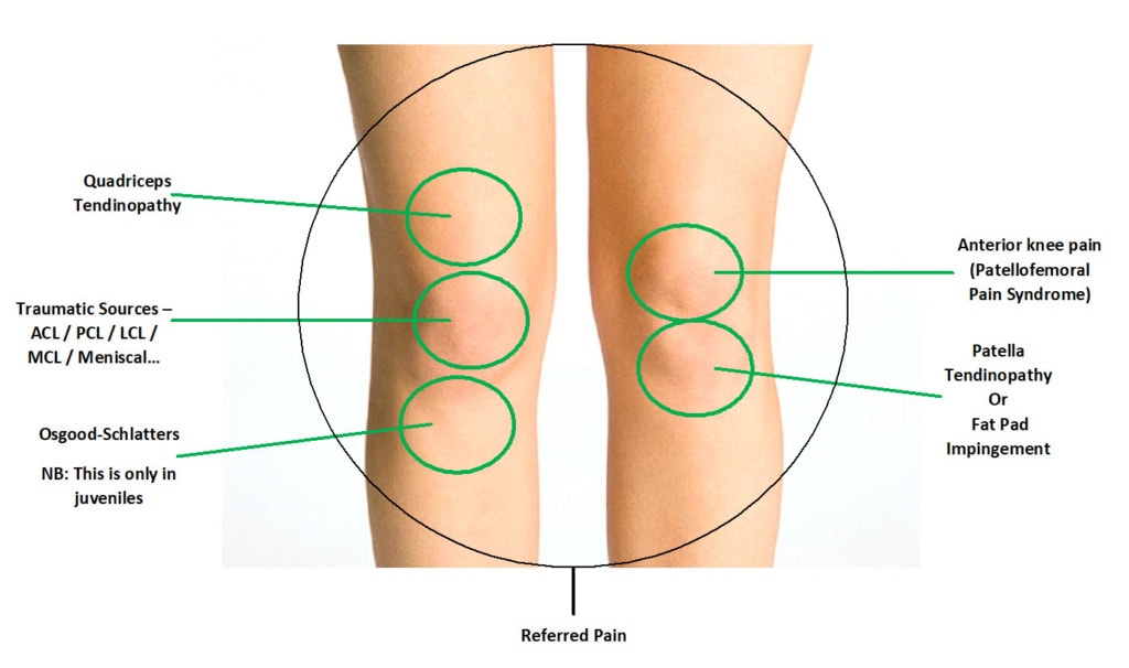 Knee pain diagram